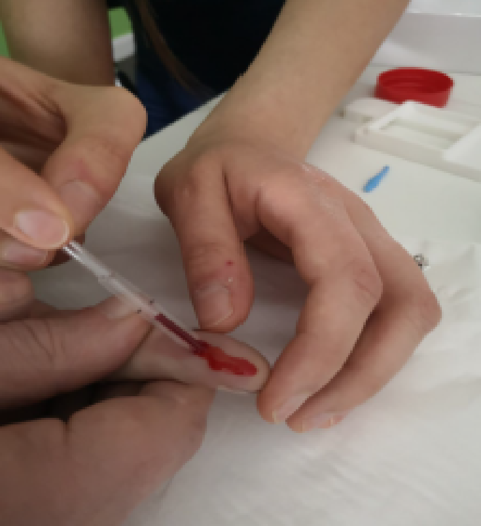 Collecting blood sample with fixed volume pipet