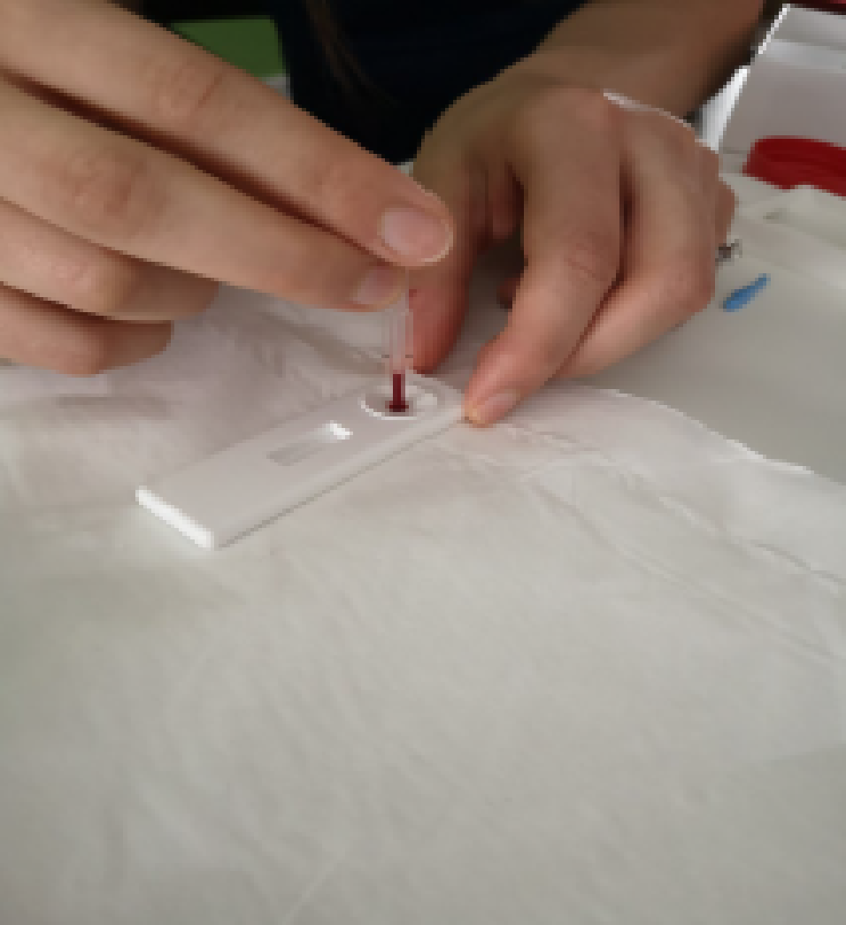 Adding buffer solution to the lateral flow device